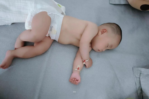 中山宝宝脸上有白色斑块